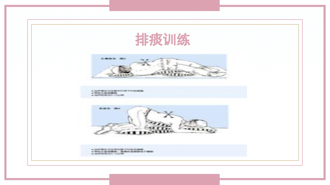肋骨骨折病人的护理PPT课件32