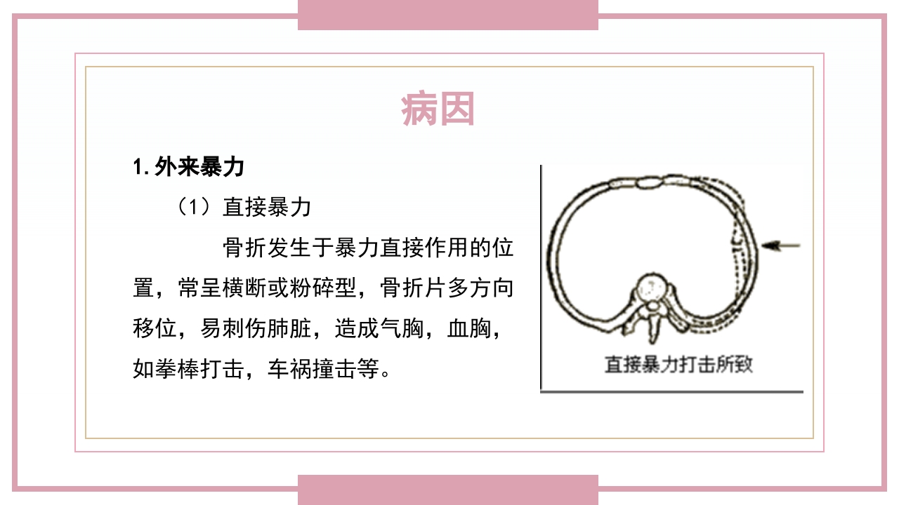 肋骨骨折病人的护理PPT课件6
