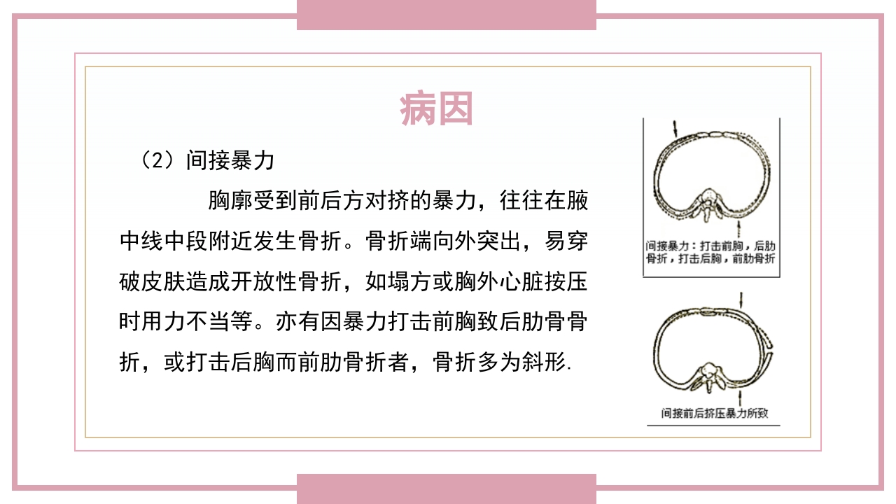 肋骨骨折病人的护理PPT课件7