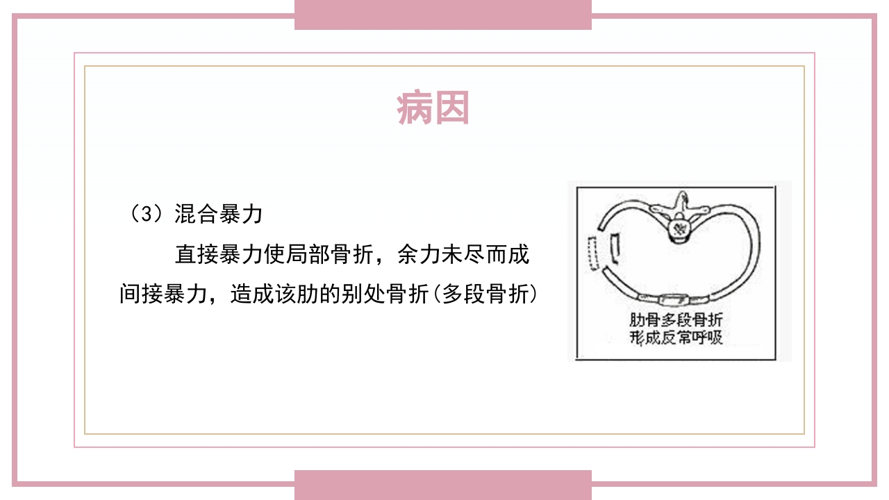 肋骨骨折病人的护理PPT课件8