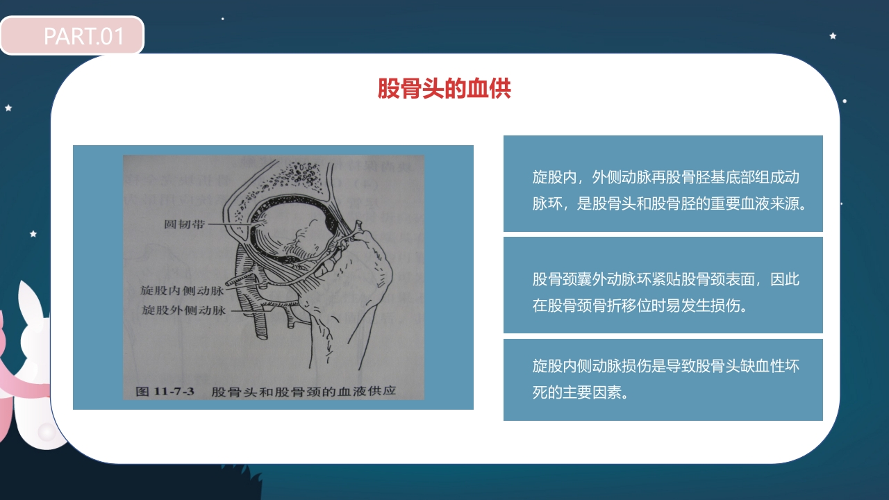 股骨颈骨折护理查房PPT课件11