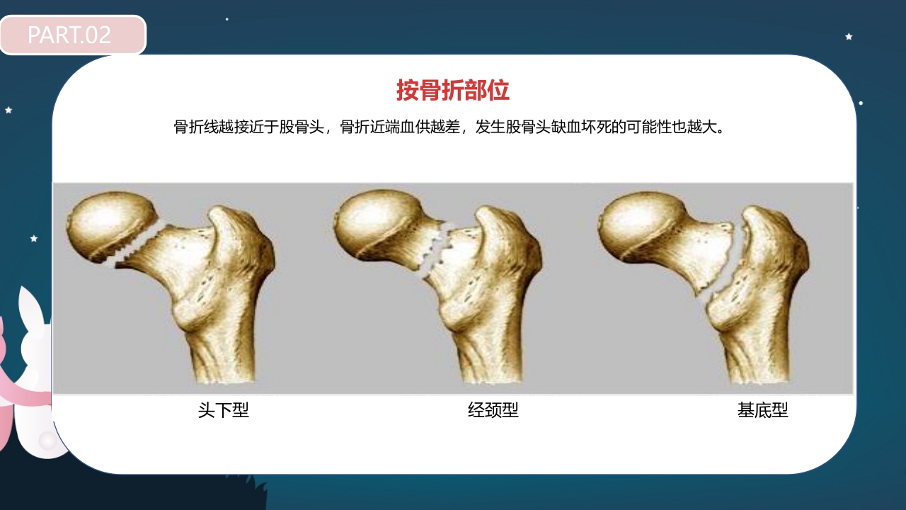 股骨颈骨折护理查房PPT课件13