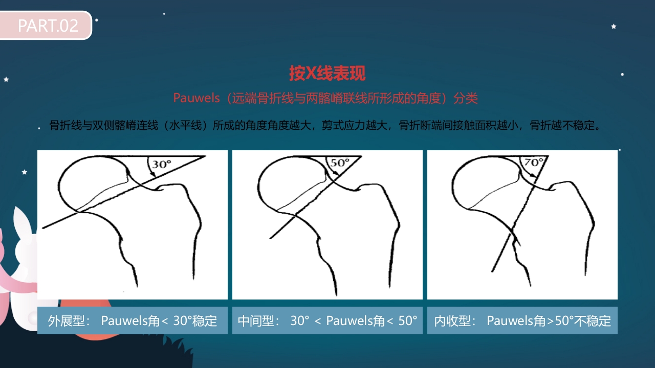 股骨颈骨折护理查房PPT课件14