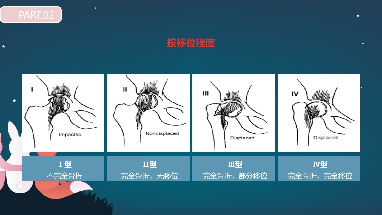股骨颈骨折护理查房PPT课件15