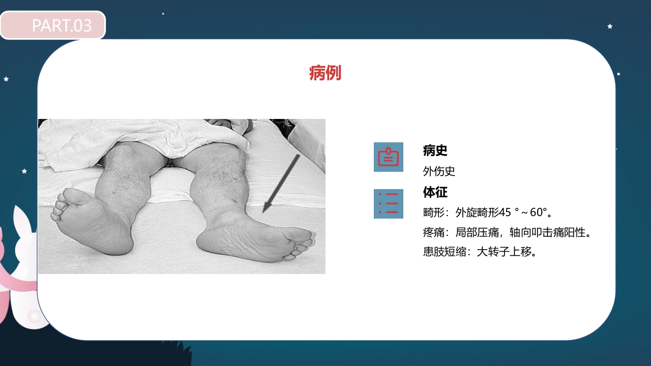 股骨颈骨折护理查房PPT课件17