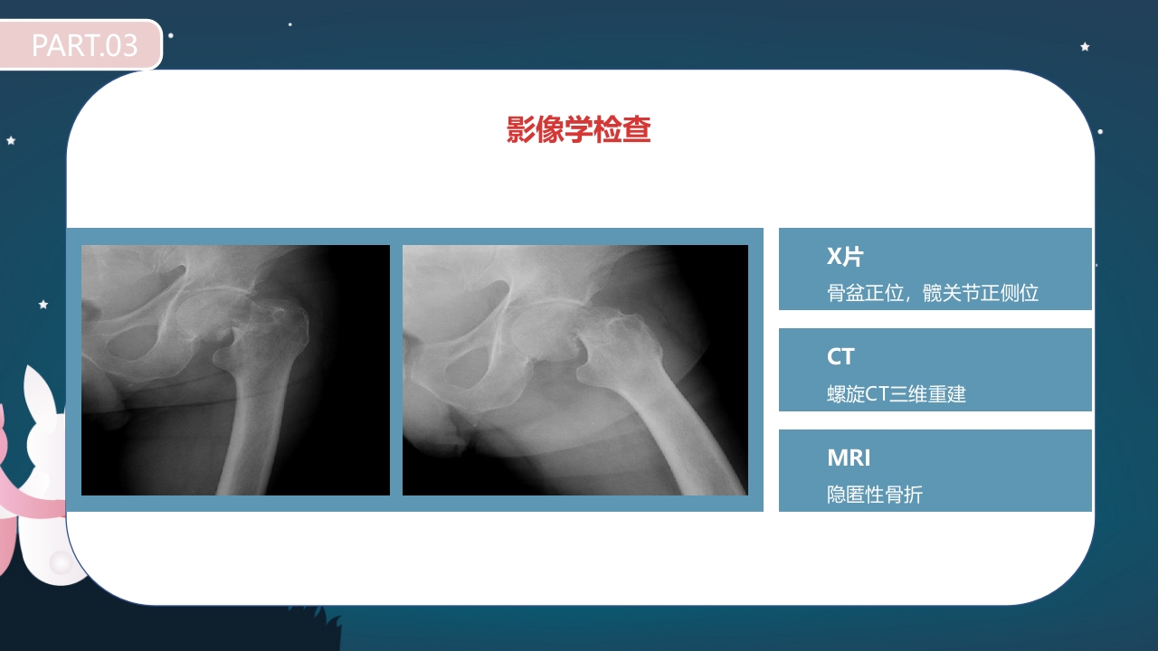 股骨颈骨折护理查房PPT课件19