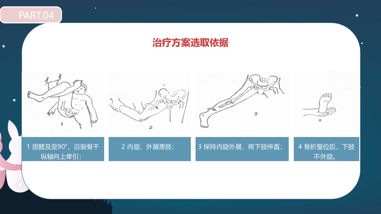 股骨颈骨折护理查房PPT课件24