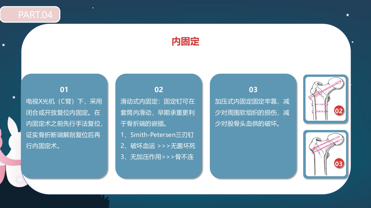 股骨颈骨折护理查房PPT课件28