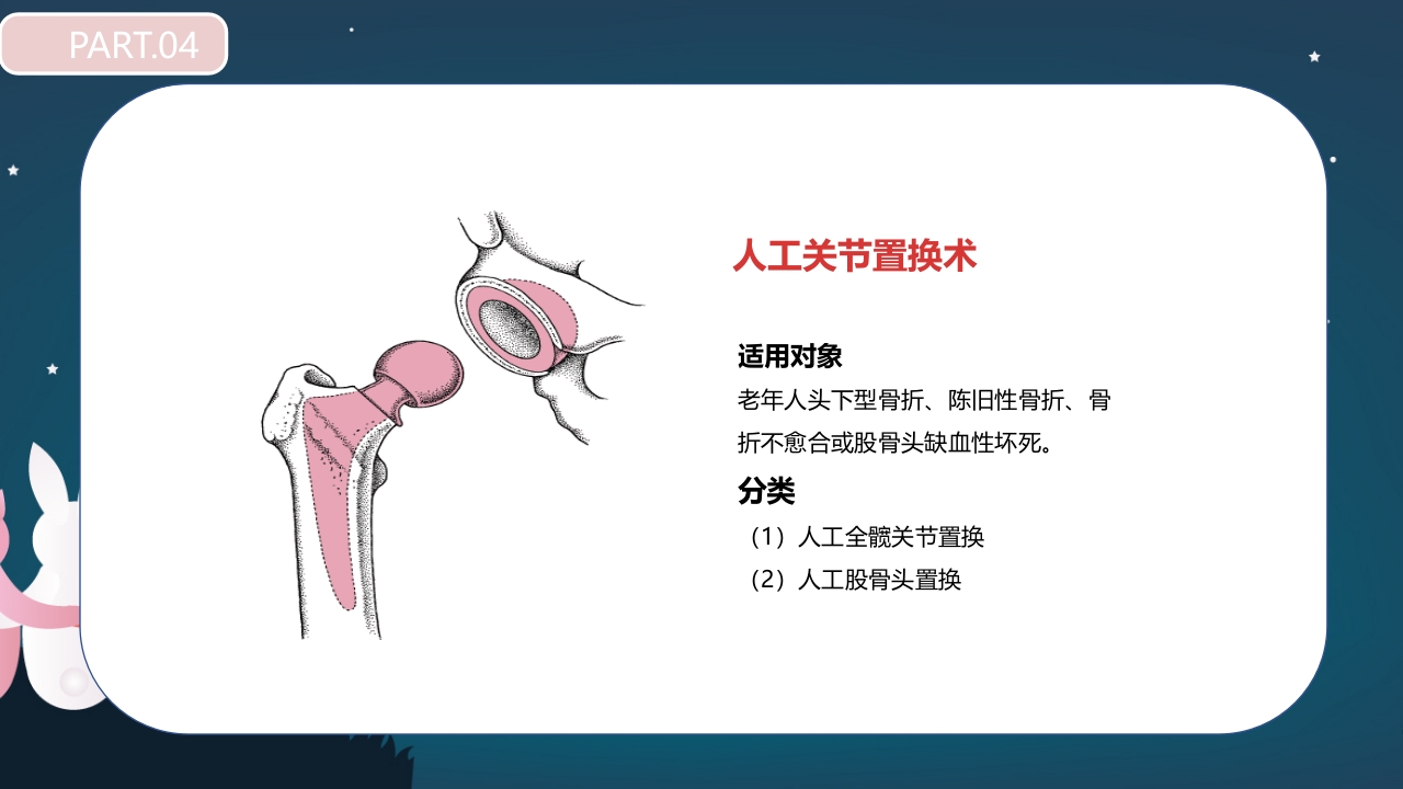 股骨颈骨折护理查房PPT课件31