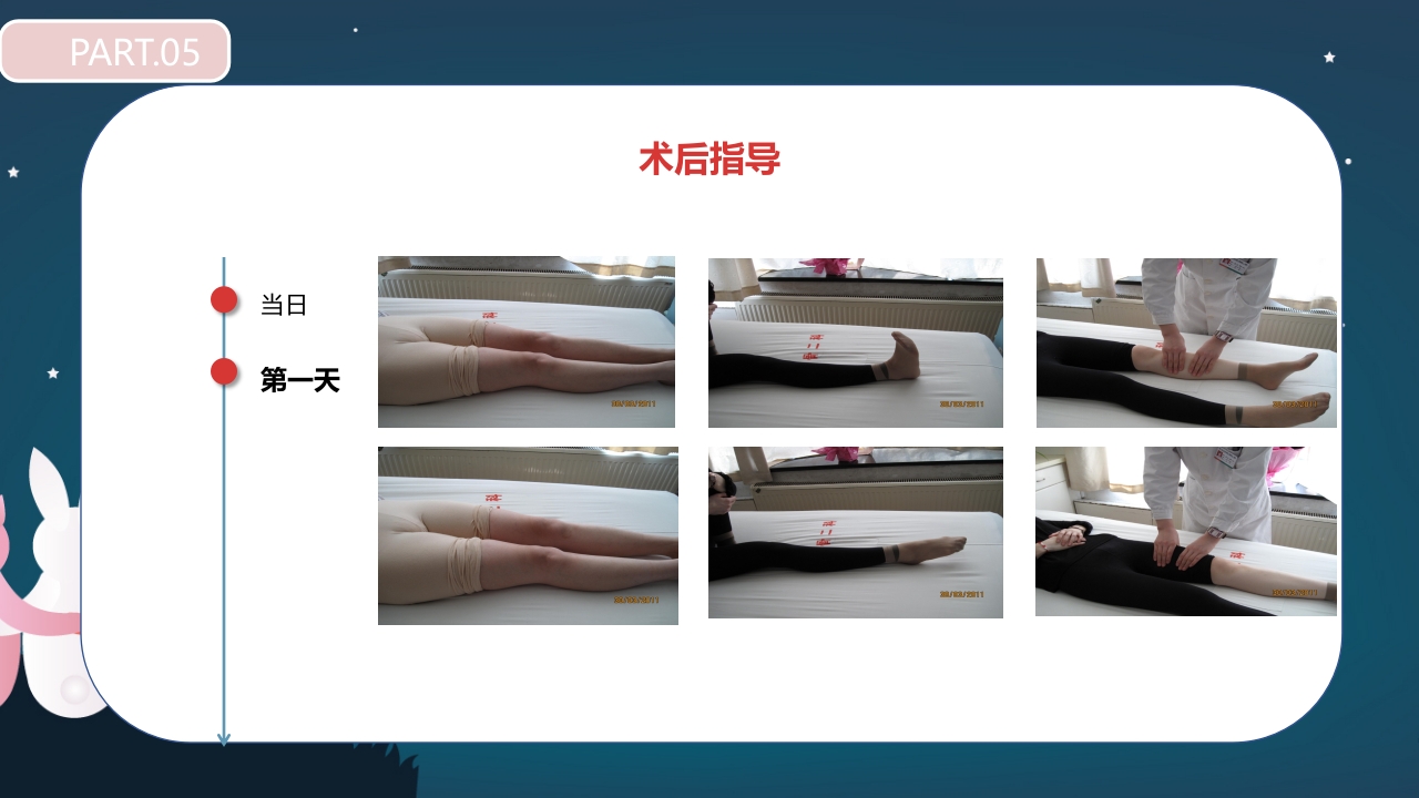 股骨颈骨折护理查房PPT课件48