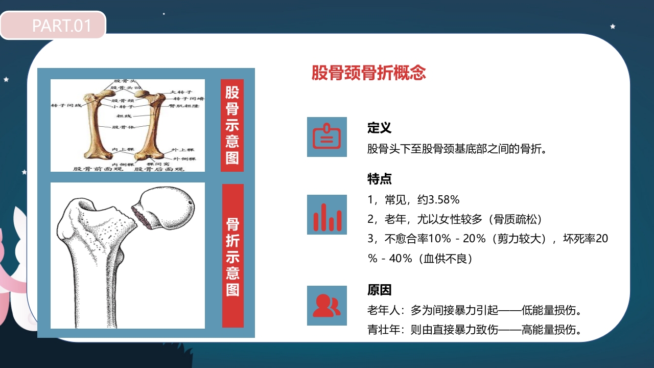 股骨颈骨折护理查房PPT课件6