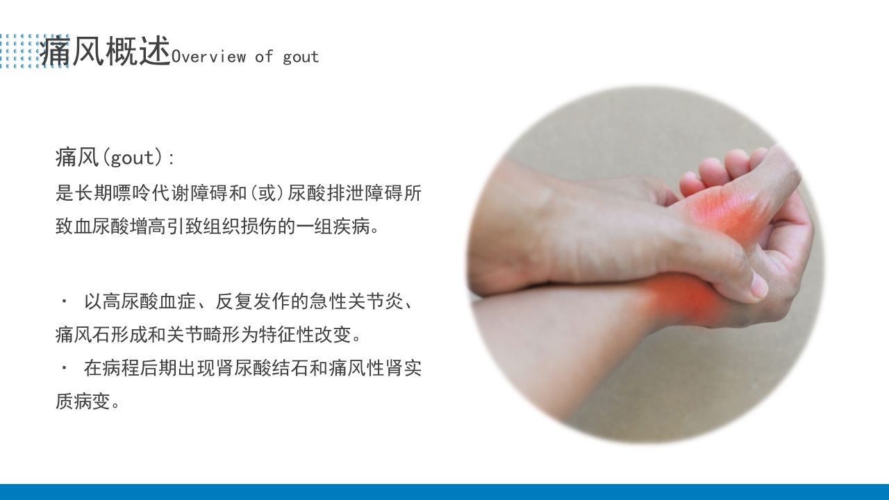 痛风患者护理培训PPT课件4