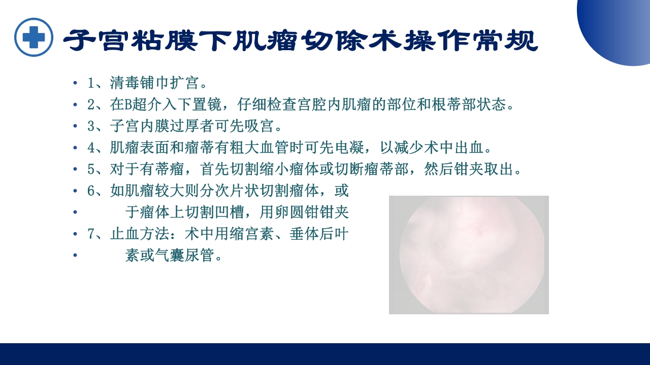 宫腔镜的适应症禁忌症及术中注意事项PPT课件32