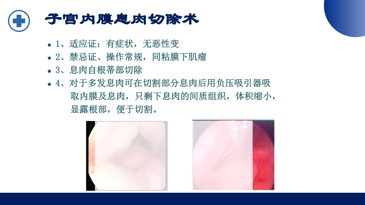 宫腔镜的适应症禁忌症及术中注意事项PPT课件35