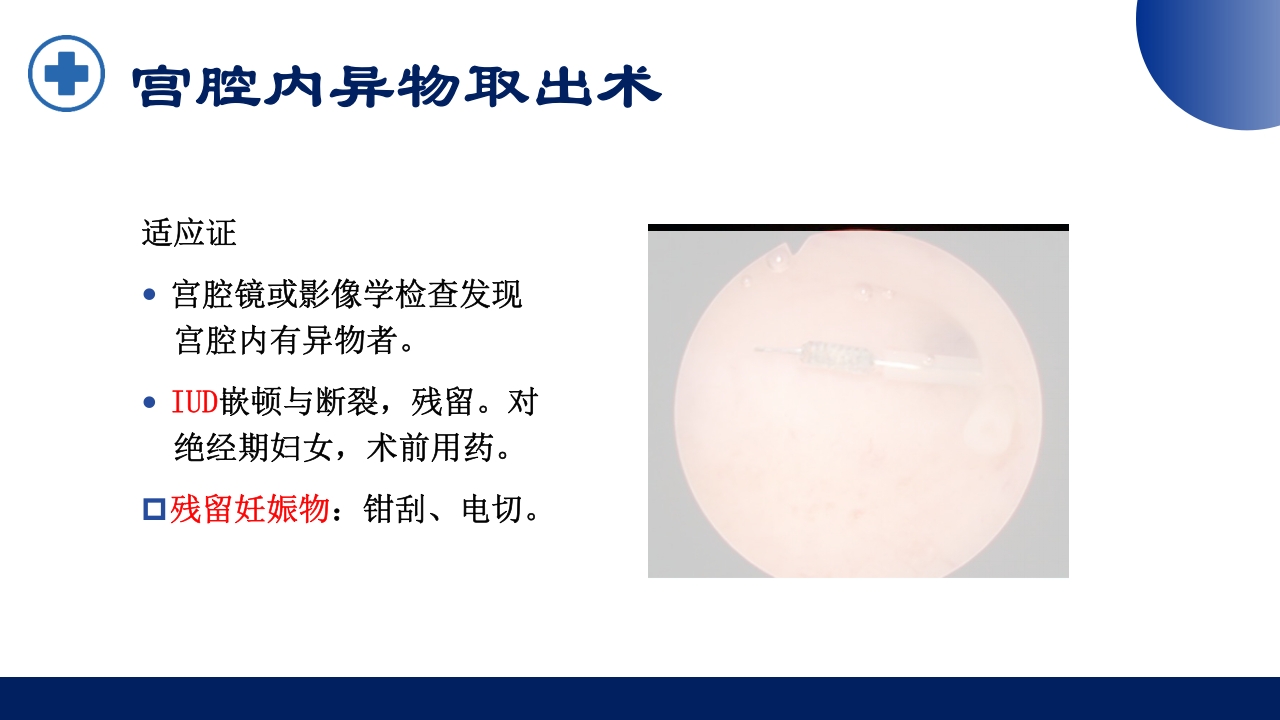 宫腔镜的适应症禁忌症及术中注意事项PPT课件36