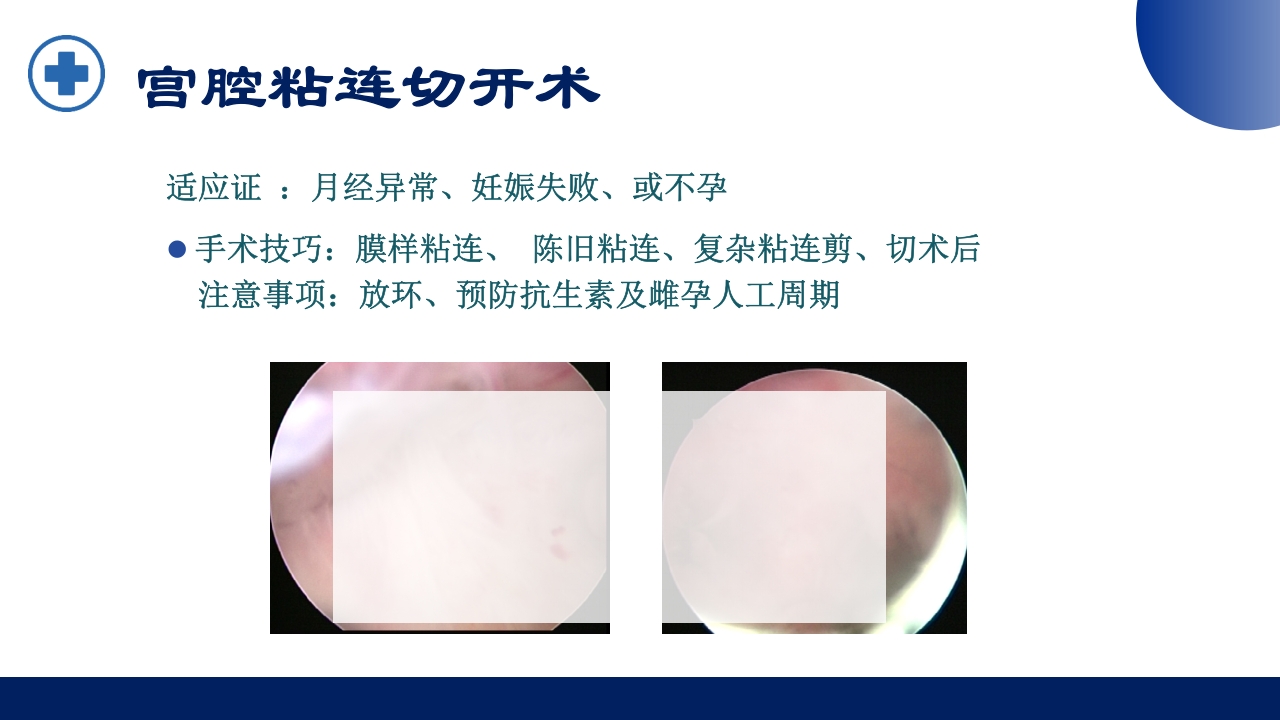 宫腔镜的适应症禁忌症及术中注意事项PPT课件39