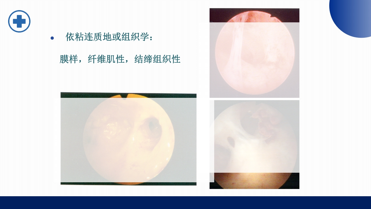 宫腔镜的适应症禁忌症及术中注意事项PPT课件40