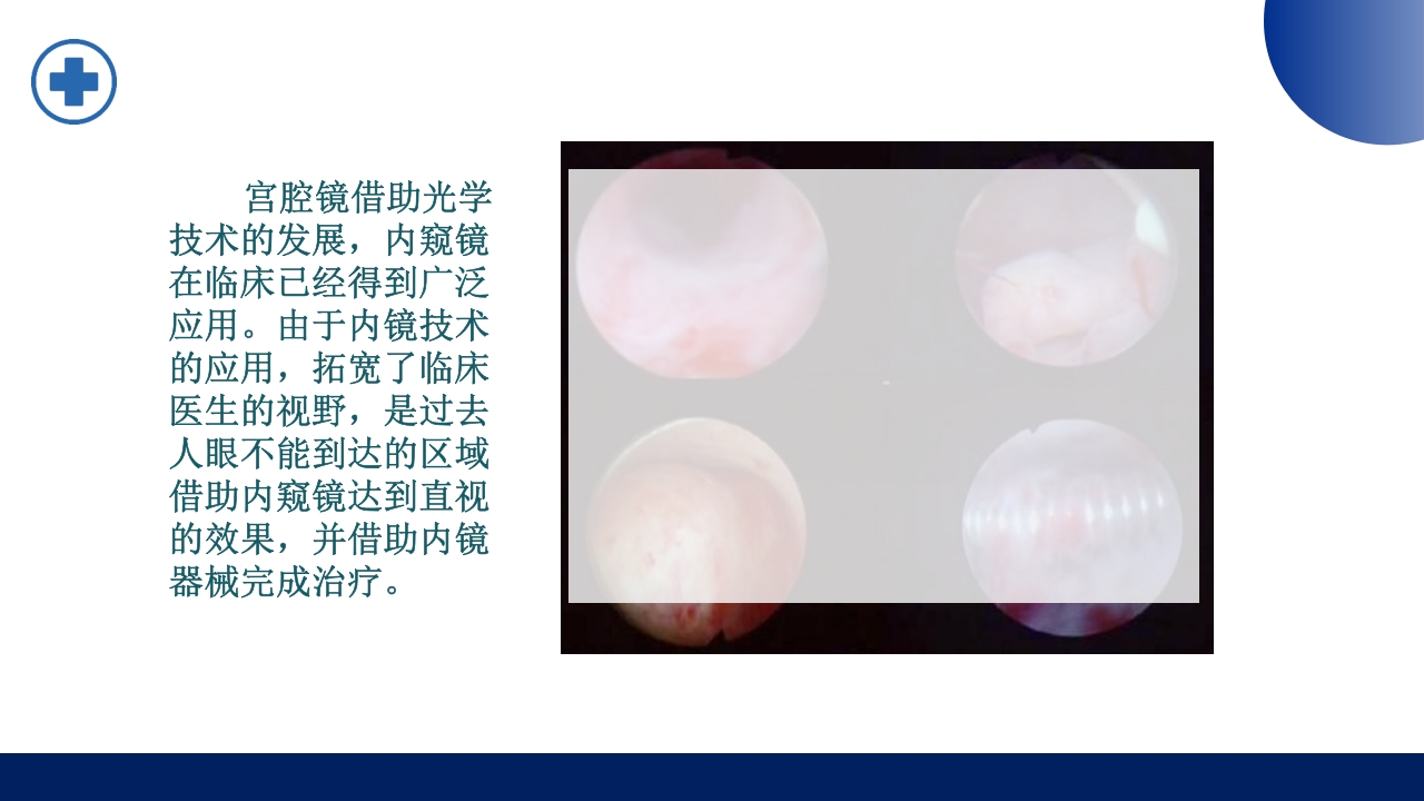 宫腔镜的适应症禁忌症及术中注意事项PPT课件4