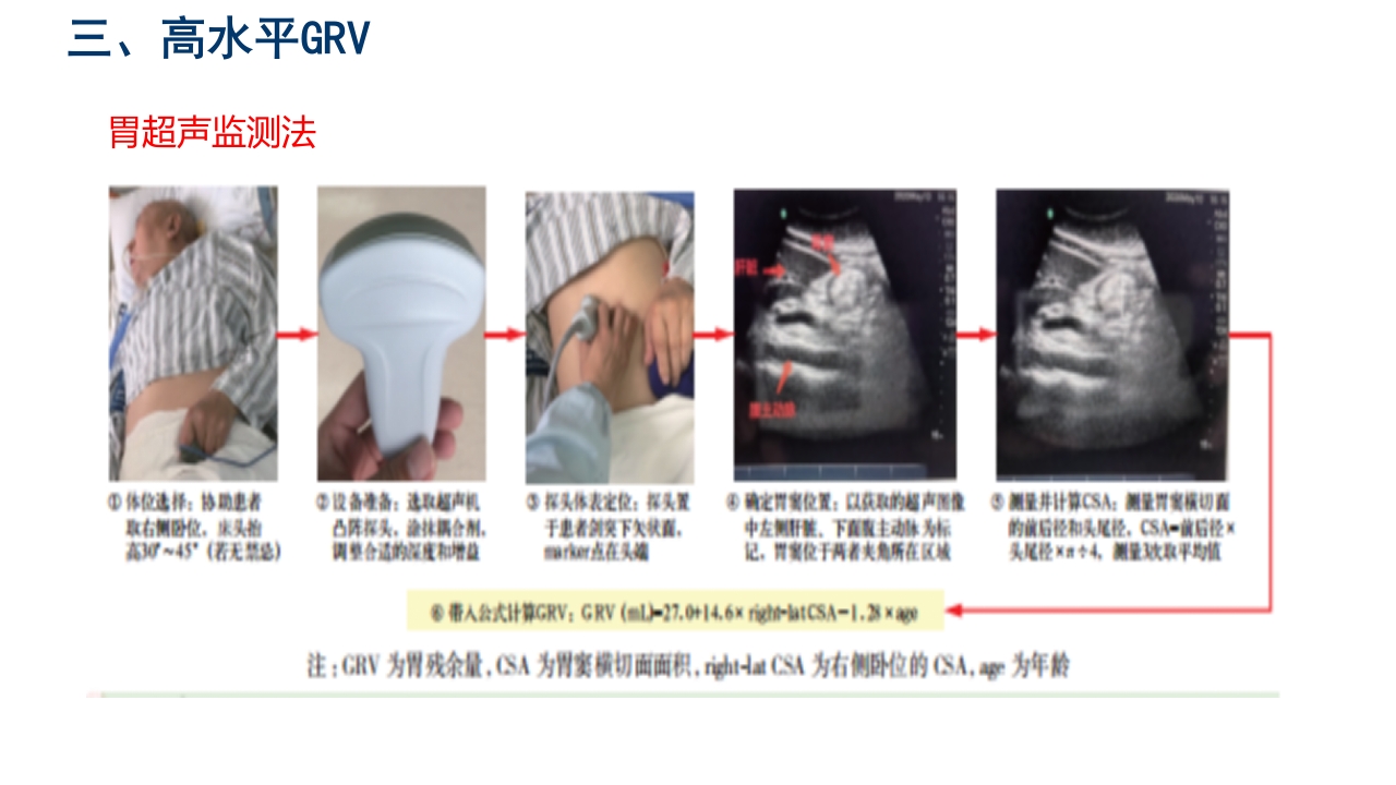 中国危重症患者肠内营养支持常见并发症预防管理专家共识PPT课件22