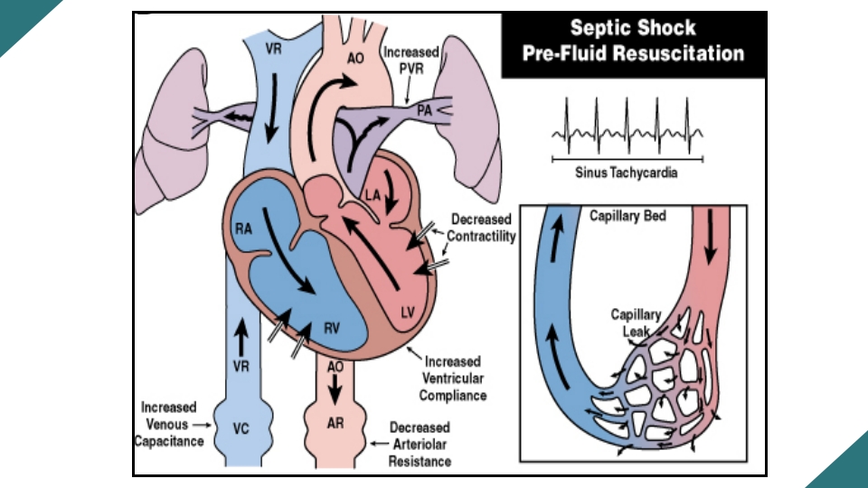 感染性休克的诊断与治疗PPT课件14