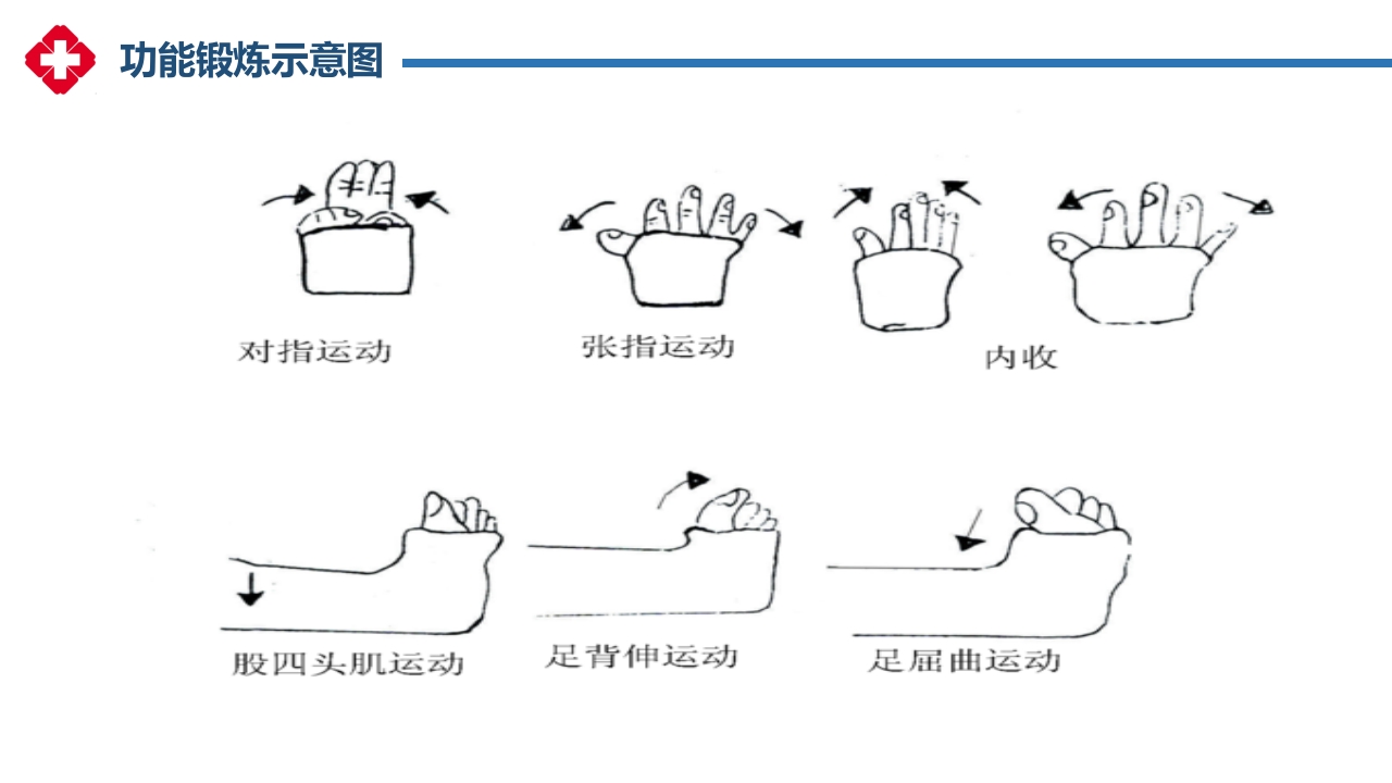 石膏固定的护理PPT课件19