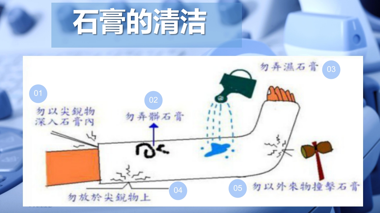 石膏固定的护理PPT课件21