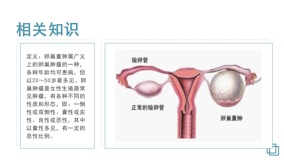 卵巢囊肿护理教学查房PPT课件4