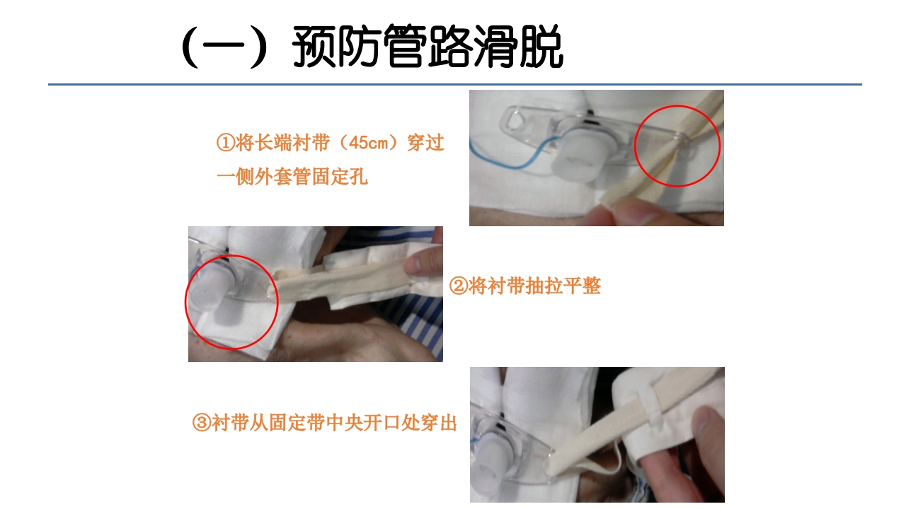 各类导管脱出的护理PPT课件20