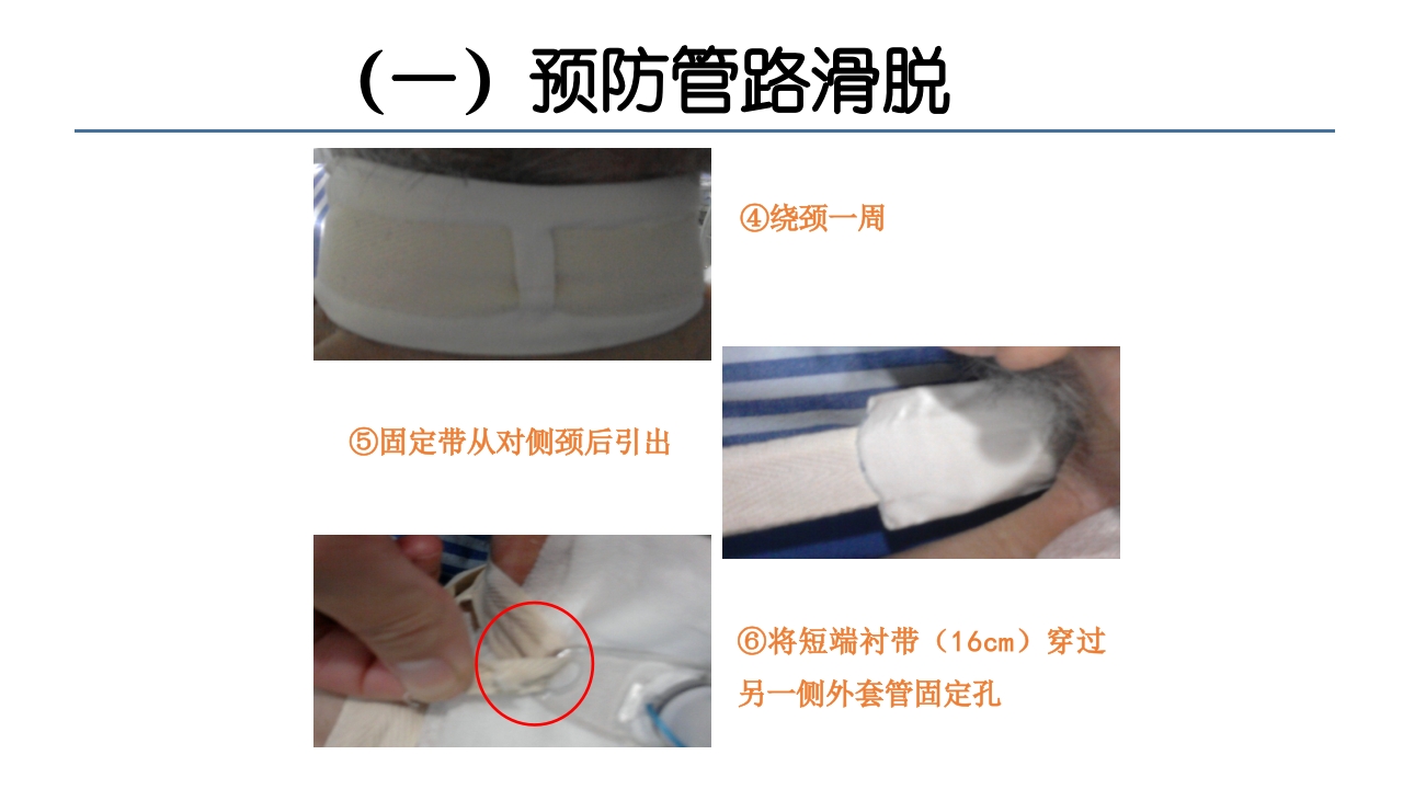 各类导管脱出的护理PPT课件21