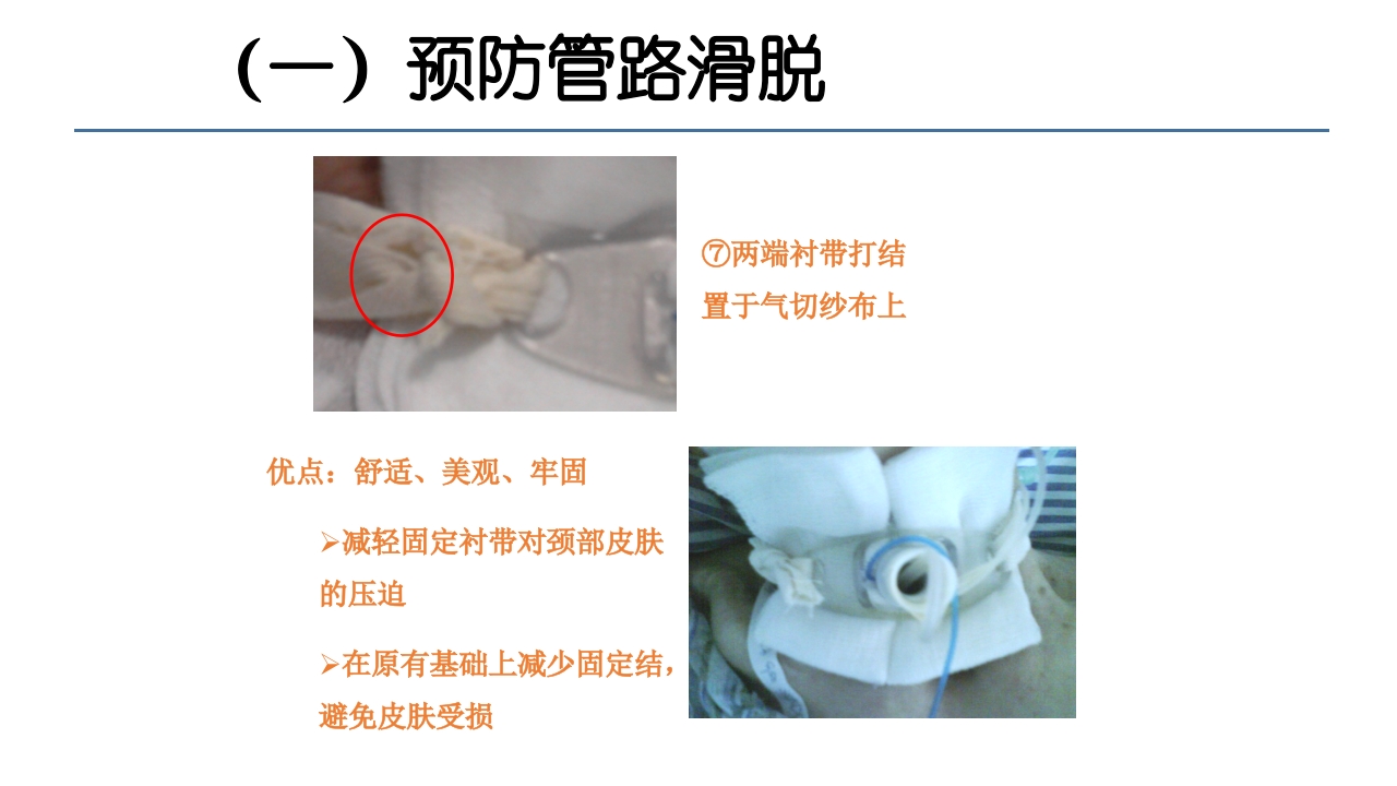 各类导管脱出的护理PPT课件22