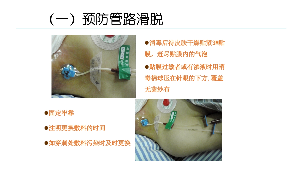 各类导管脱出的护理PPT课件27