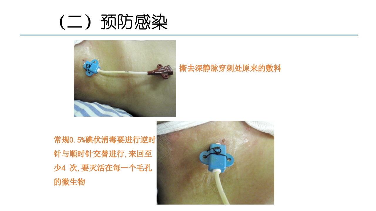 各类导管脱出的护理PPT课件29