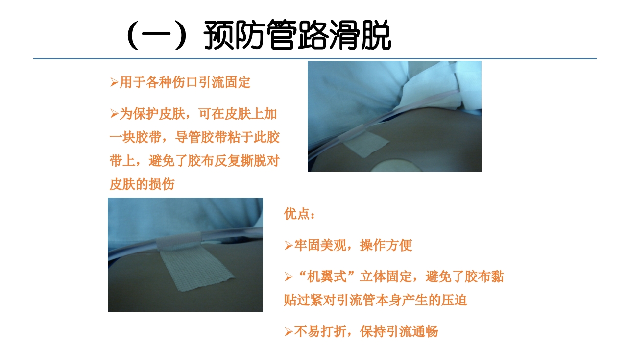 各类导管脱出的护理PPT课件33