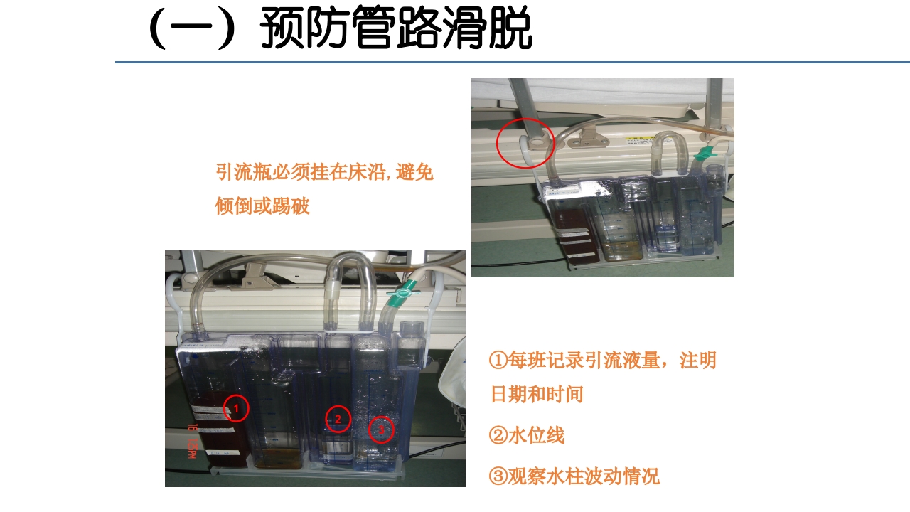 各类导管脱出的护理PPT课件42