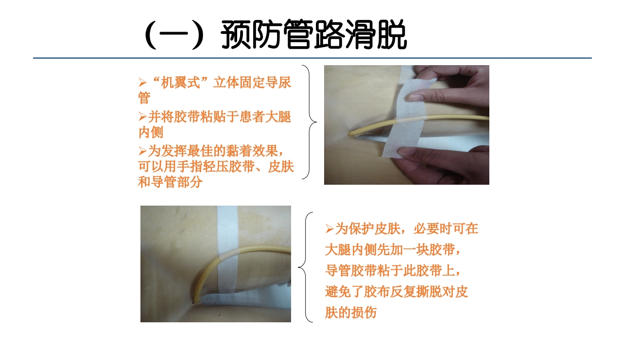 各类导管脱出的护理PPT课件48