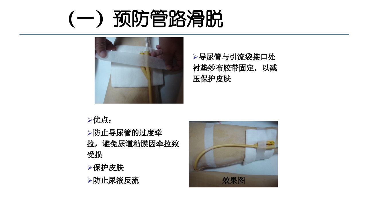 各类导管脱出的护理PPT课件49