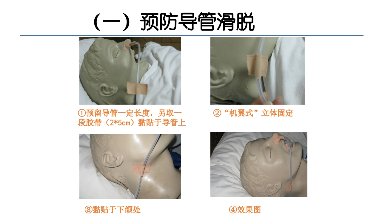 各类导管脱出的护理PPT课件5