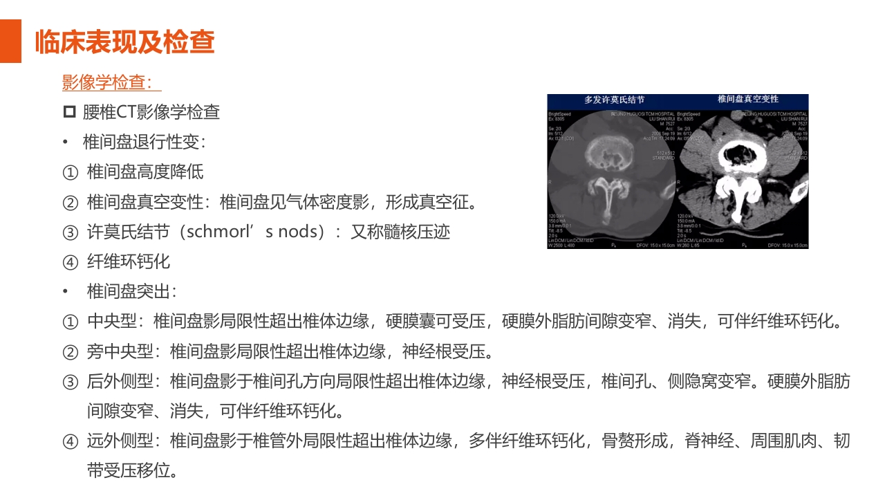 腰椎间盘突出症护理查房PPT课件19