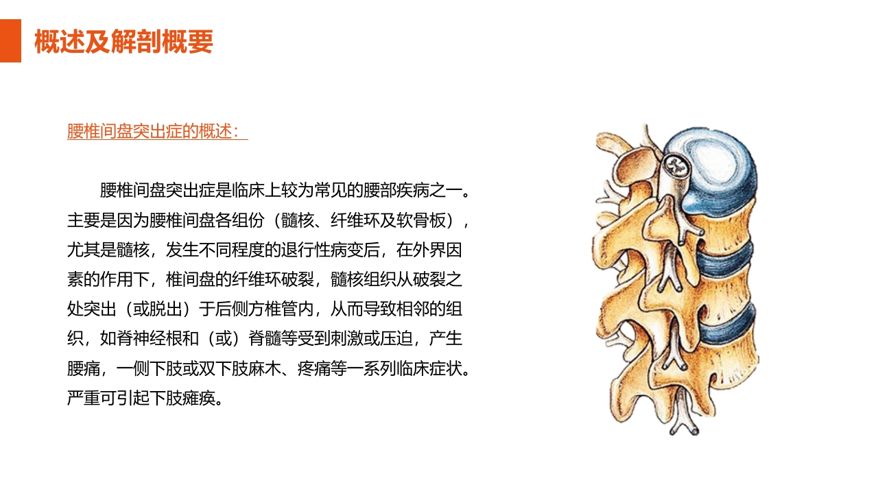 腰椎间盘突出症护理查房PPT课件4