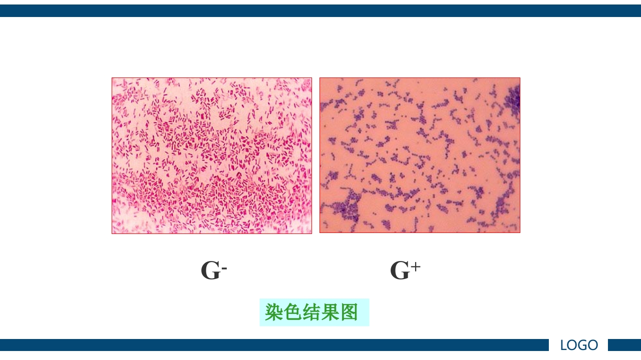微生物实验·细菌的人工培养及形态学检查PPT课件68