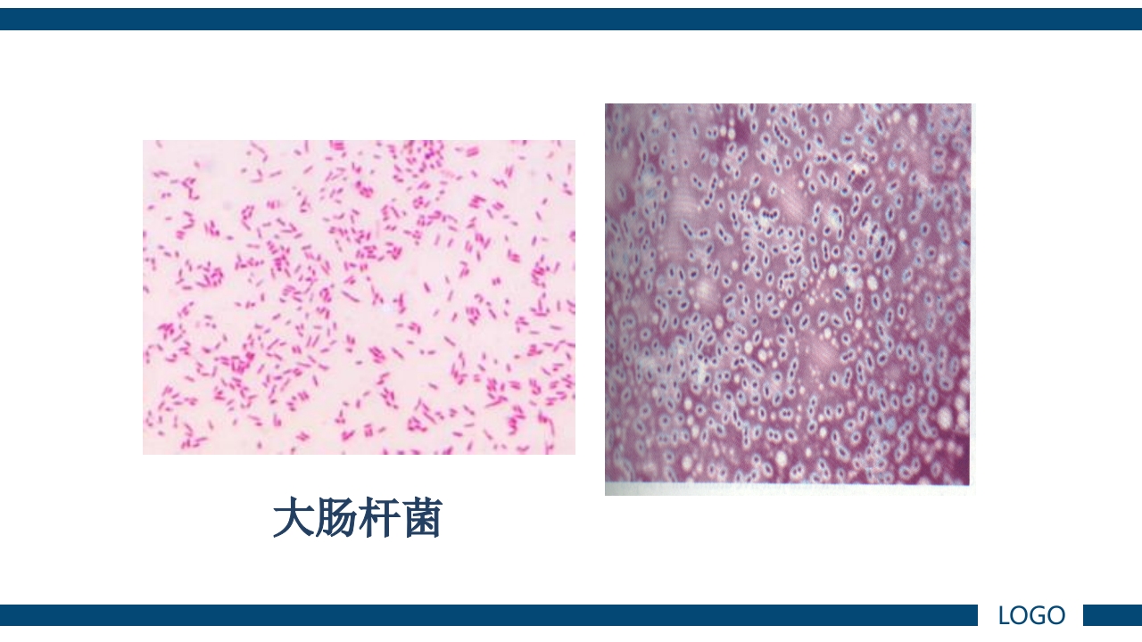 微生物实验·细菌的人工培养及形态学检查PPT课件73