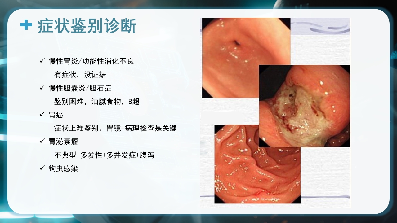 消化性溃疡的健康教育PPT课件10