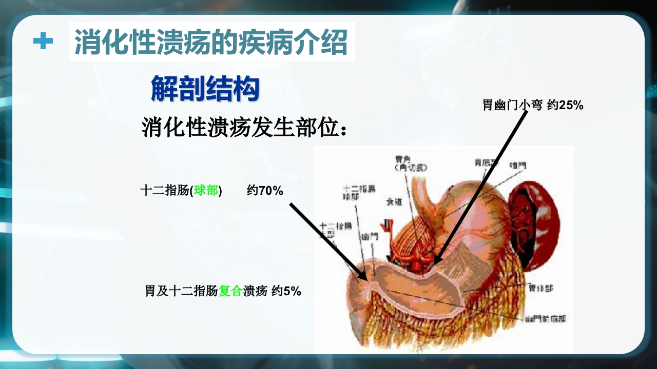 消化性溃疡的健康教育PPT课件4