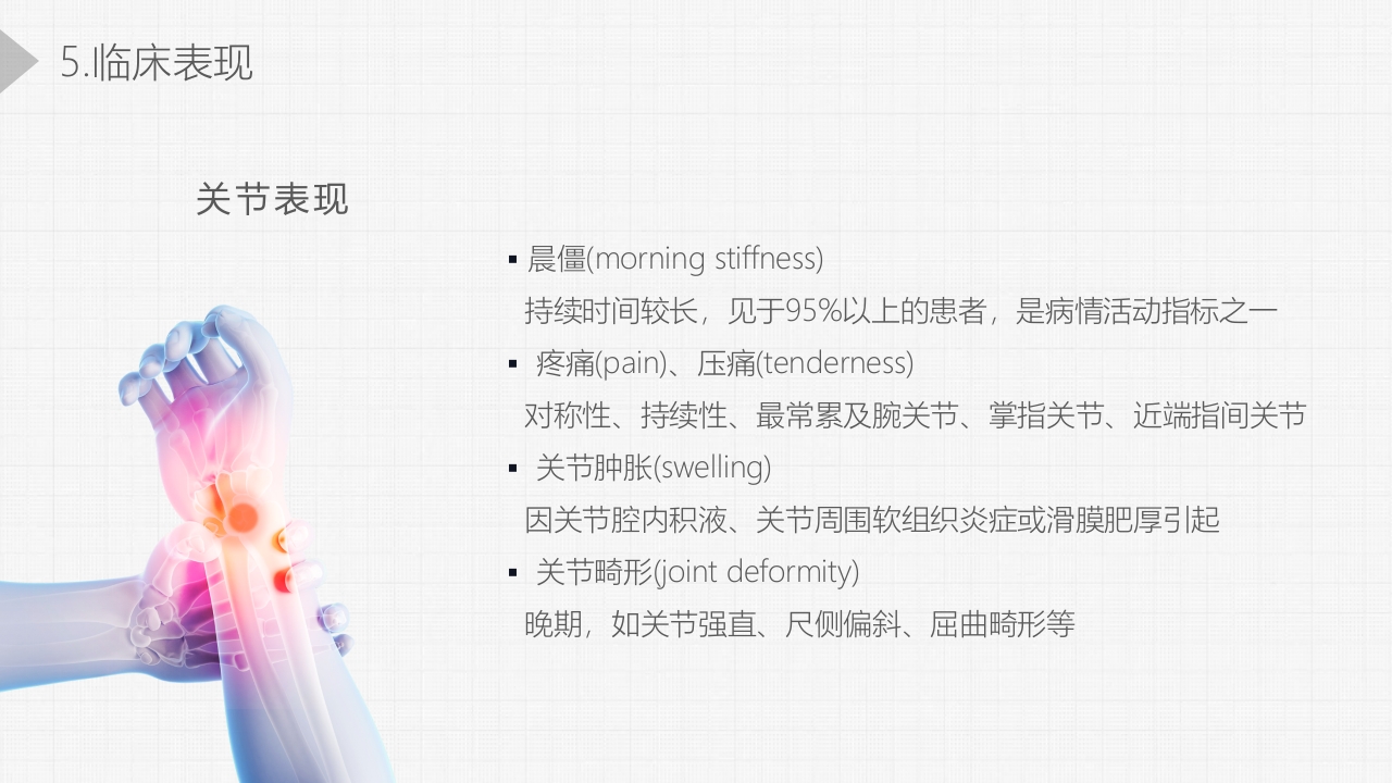 类风湿关节炎详细内容PPT课件11