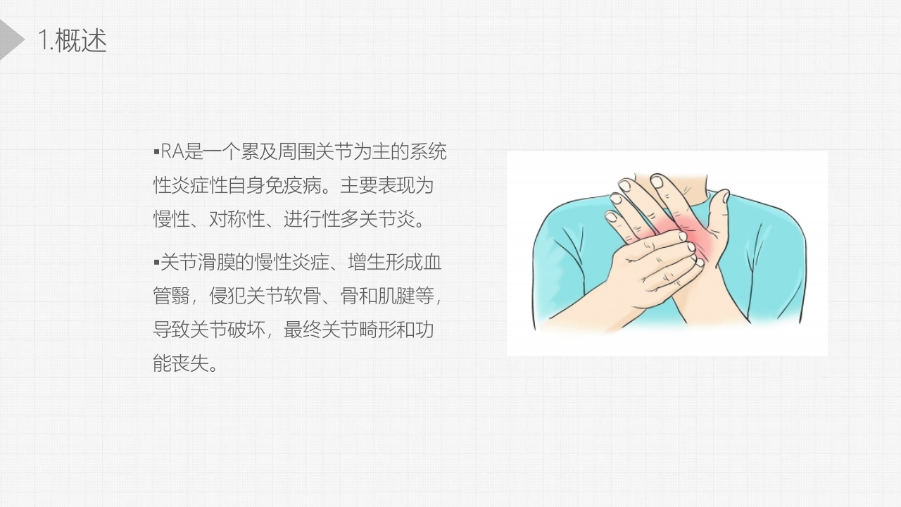 类风湿关节炎详细内容PPT课件3