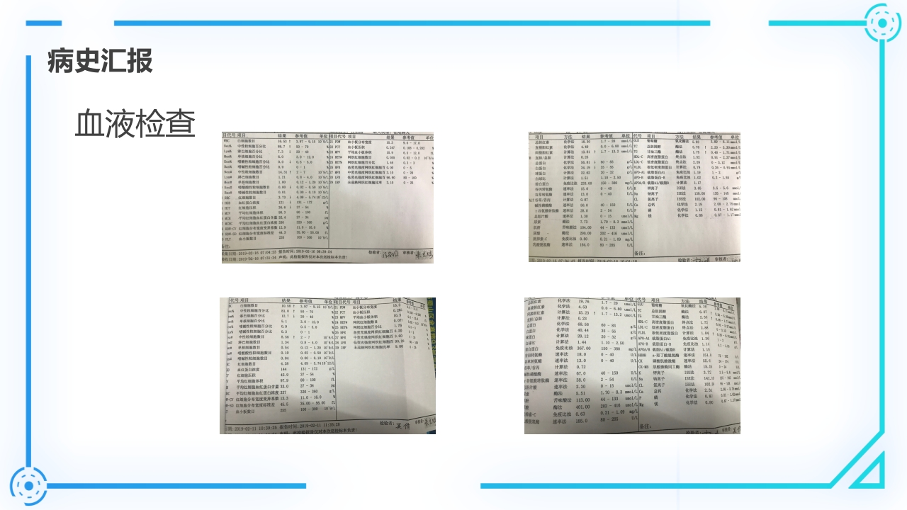 腰椎间盘突出症护理查房PPT课件20