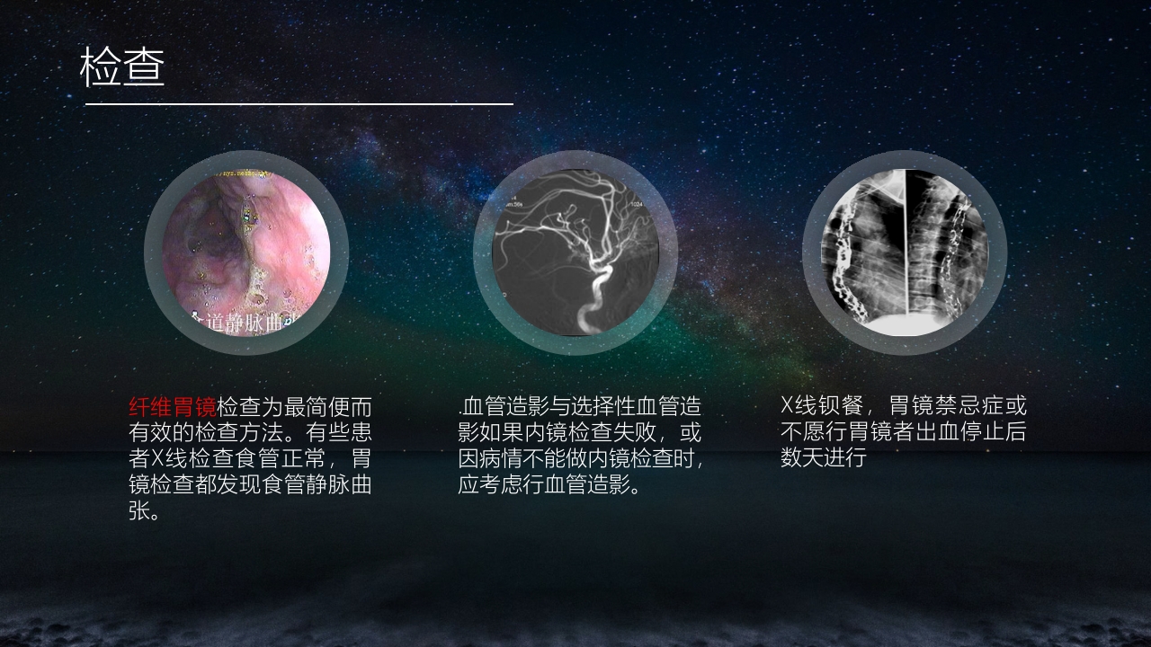 食管胃底静脉曲张护理查房PPT课件11