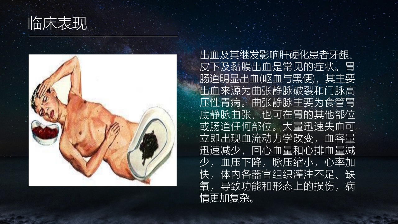 食管胃底静脉曲张护理查房PPT课件4