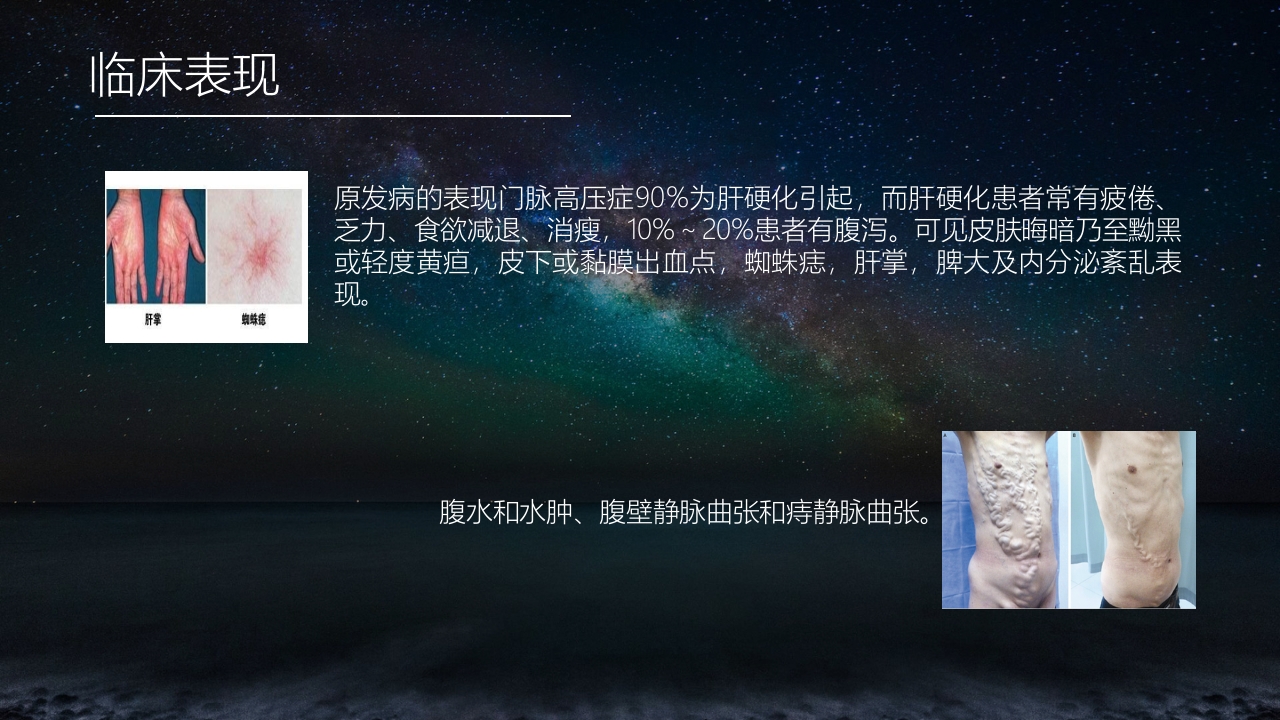 食管胃底静脉曲张护理查房PPT课件5
