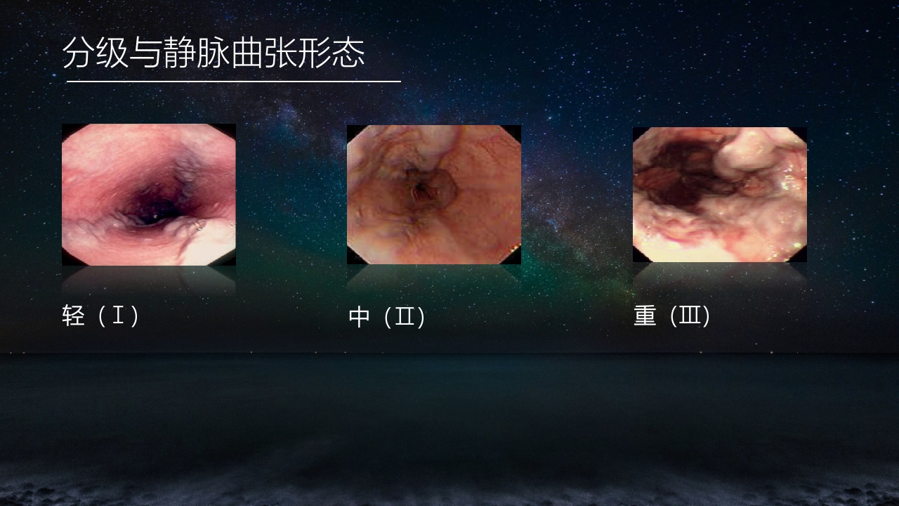 食管胃底静脉曲张护理查房PPT课件7
